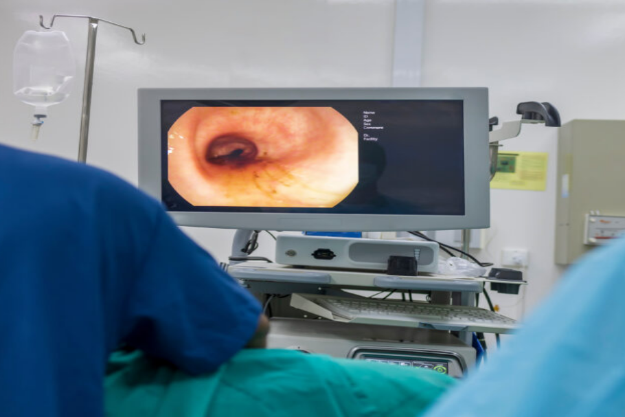 smartmed-colonoscopy